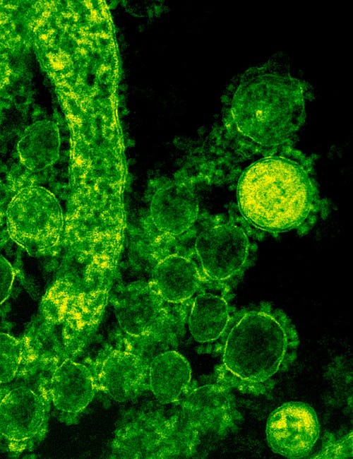 The Hidden World of Microbes in Your Home